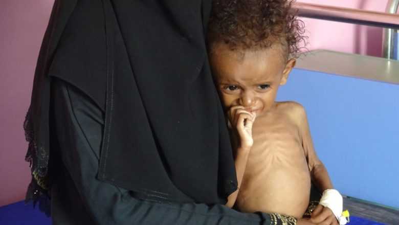 Yemen’de 2019’da 100 bin çocuk koleraya yakalandı