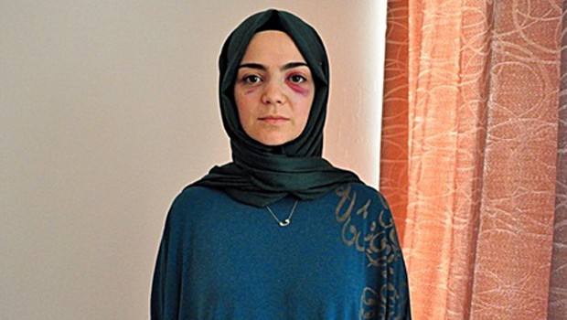 Almanya’da Türk kadını yumruklayan saldırgan Rus çıktı