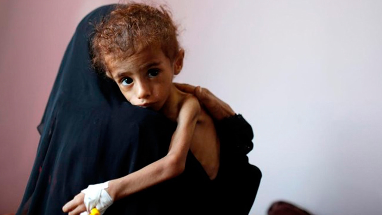 Birleşmiş Milletler’den Yemen’de kıtlık uyarısı