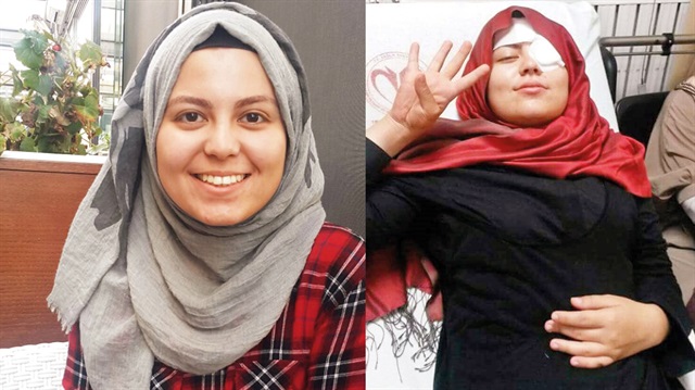 Ankara Üniversitesi’nde stand açan öğrencilere soda şişesi atanlar beraat etti