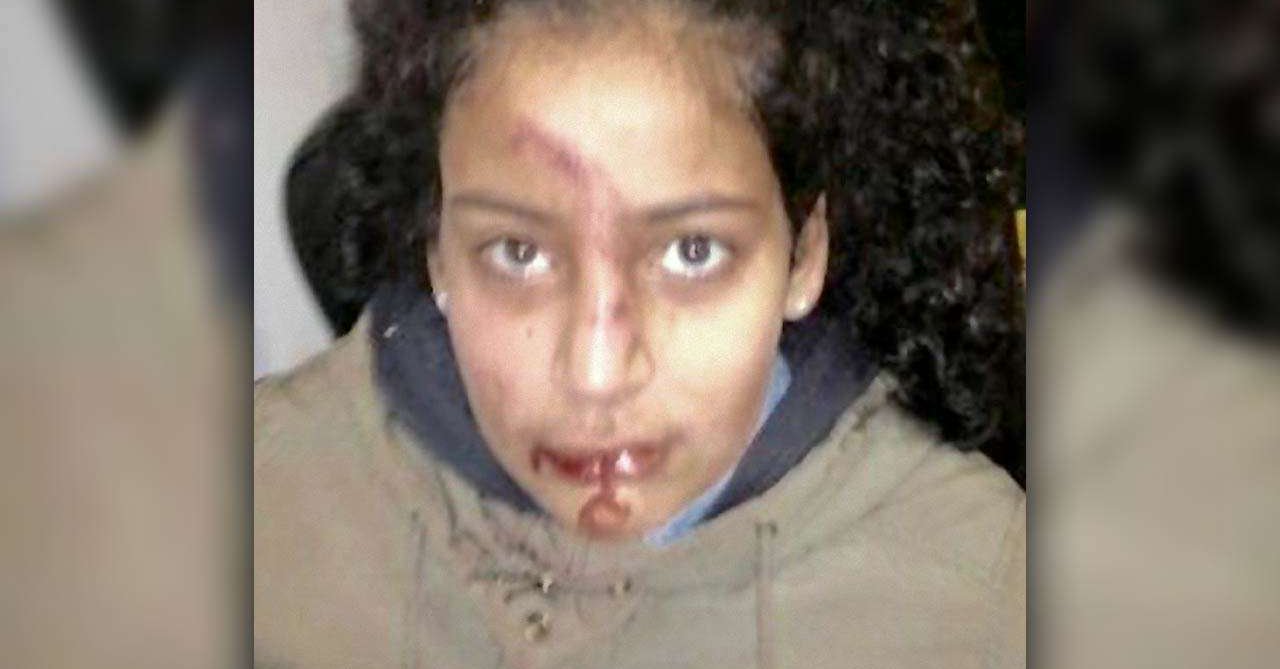 Almanya’da Naziler, 13 yaşındaki Tunuslu kızı tekmeledi ve yüzüne bastı!