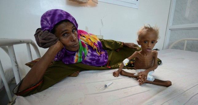 World will see largest famine in decades if Saudi blockade not lifted in Yemen, UN warns