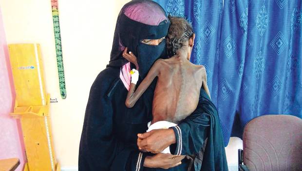 In Yemen, a mother and six newborns die every two hours