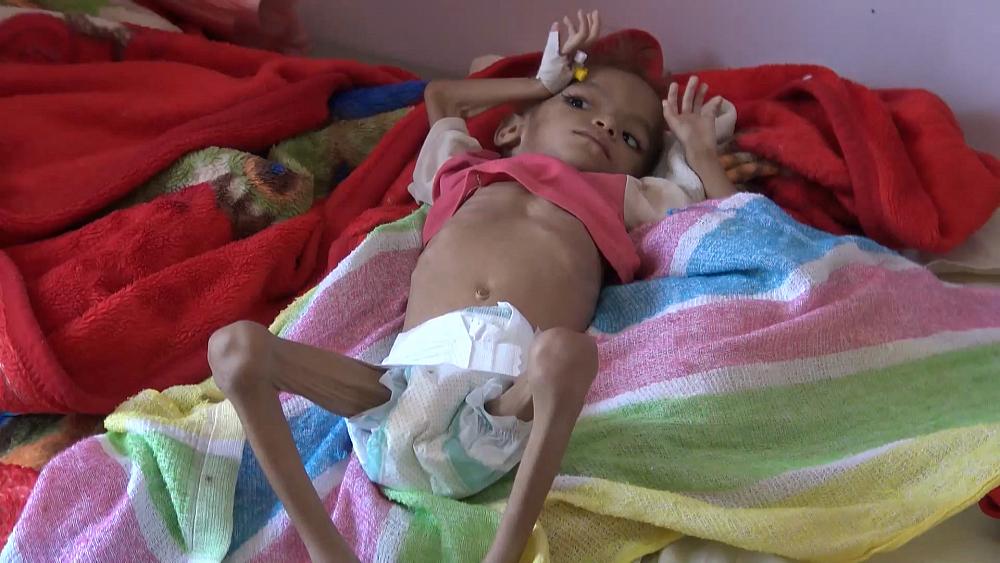 Yemen insani kriz